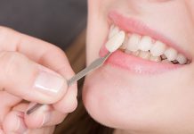 fatete dentare