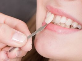 fatete dentare