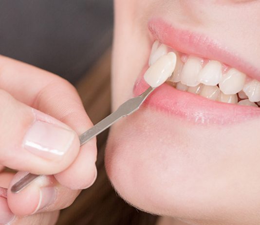 fatete dentare