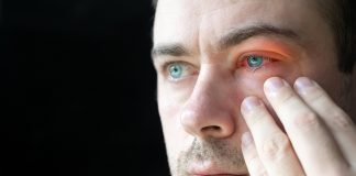 3 tipuri de conjunctivită și tot ce trebuie să știi despre ele