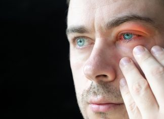 3 tipuri de conjunctivită și tot ce trebuie să știi despre ele