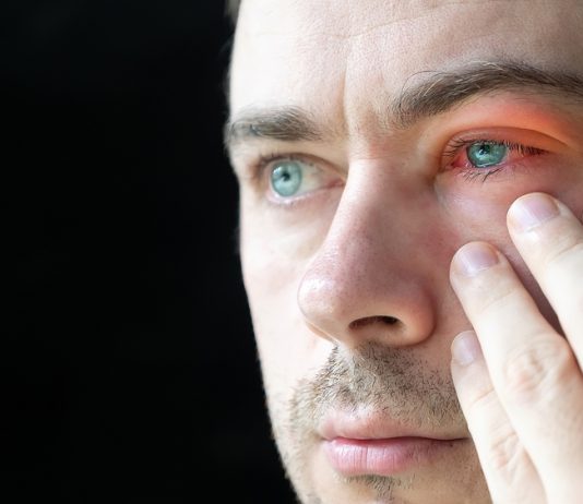 3 tipuri de conjunctivită și tot ce trebuie să știi despre ele