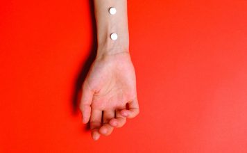 Depigmentarea pielii - 5 cauze frecvente