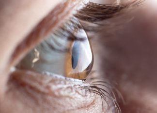 Cum recunoști astigmatismul și cum se corectează