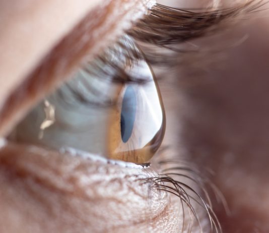 Cum recunoști astigmatismul și cum se corectează