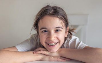 Iată care e cel mai potrivit aparat dentar pentru copii, indiferent de vârstă