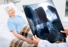Hernia cervicală: când poate fi necesară intervenția chirurgicală? Hernia cervicală: când poate fi necesară intervenția chirurgicală?