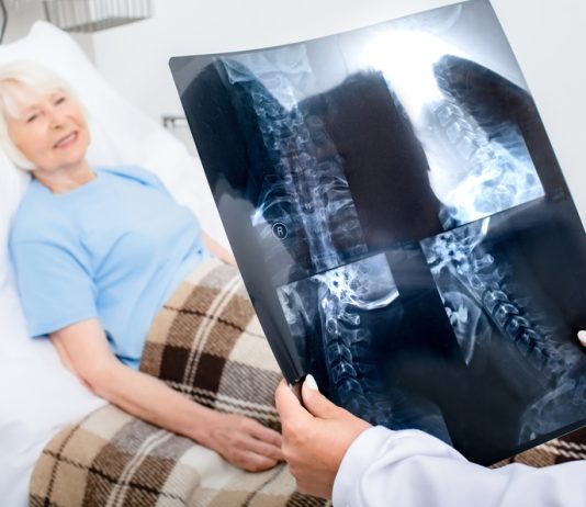 Hernia cervicală: când poate fi necesară intervenția chirurgicală? Hernia cervicală: când poate fi necesară intervenția chirurgicală?