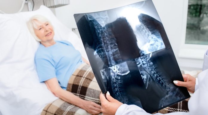 Hernia cervicală: când poate fi necesară intervenția chirurgicală?